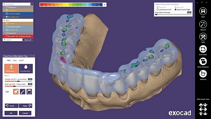 Модуль для программного обеспечения Exocad Bite splint module