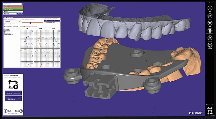 Модуль для программного обеспечения Exocad Jaw Motion Import