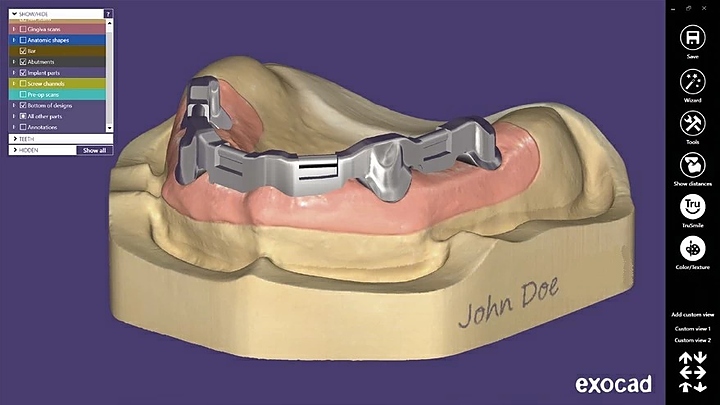 Модуль для программного обеспечения Exocad Full Denture Module