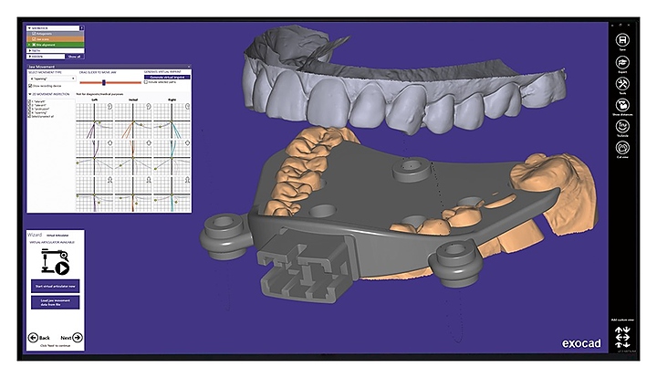 Модуль для программного обеспечения Exocad Jaw Motion Import